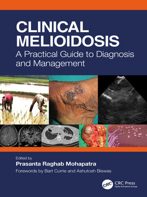 cover image of Clinical Melioidosis